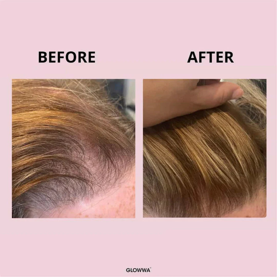 Glowwa - Orignal 60 capsules